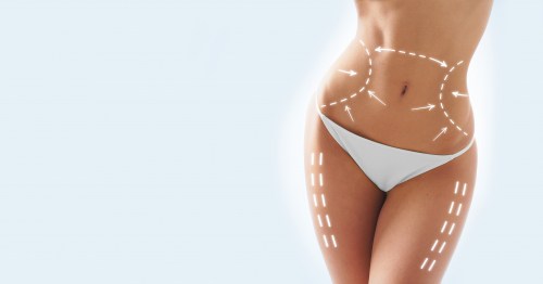 liposhape-3